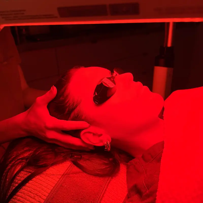 Collagen Biostimulator at The Aesthetic Lounge Cairns